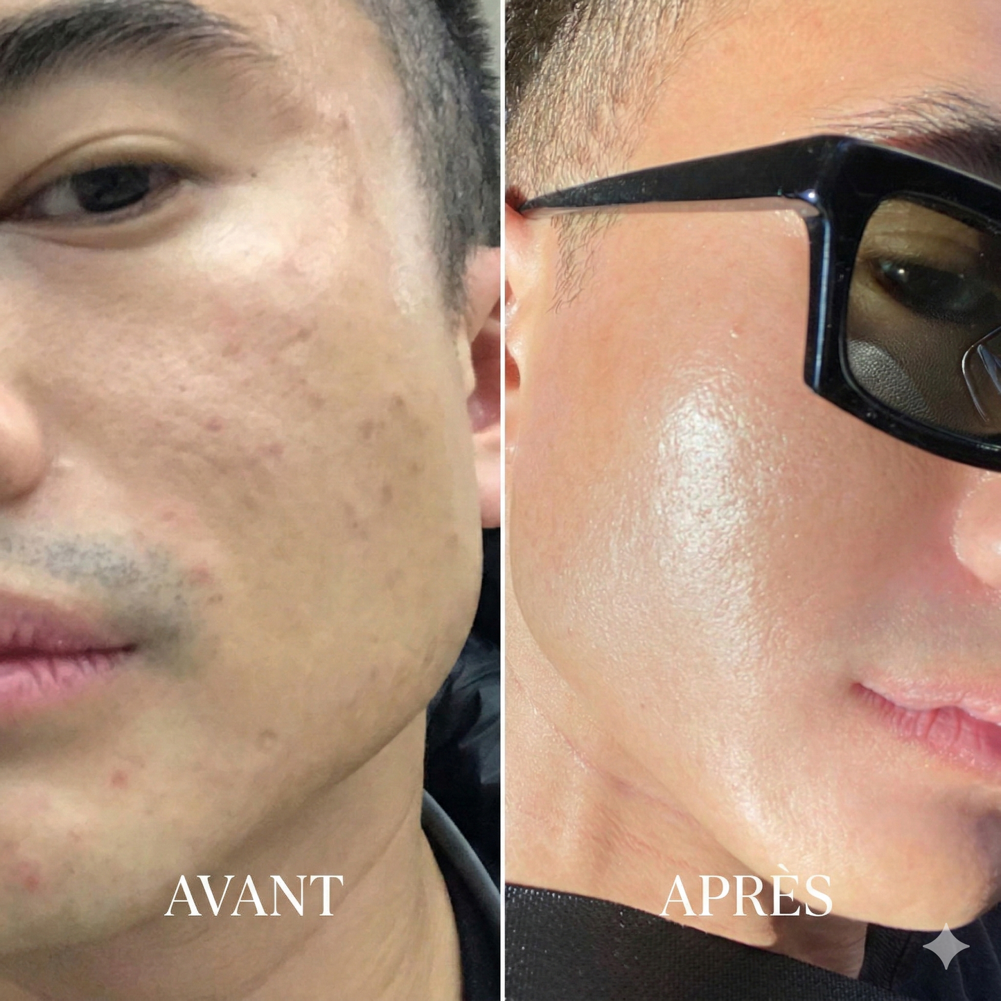 Éliminateur de points noirs