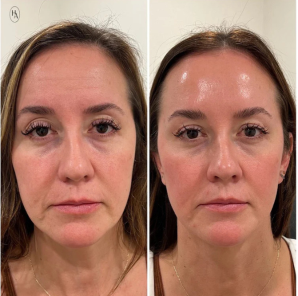 Clarisme - Peeling Glow Rice ™
